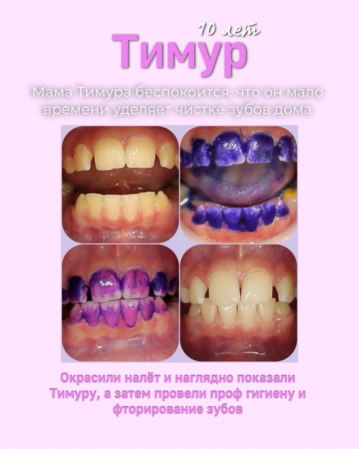 Клинический случай до и после
