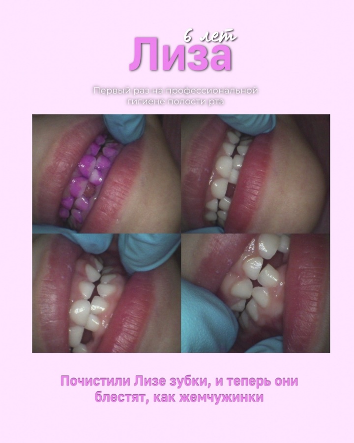 Клинический случай до и после