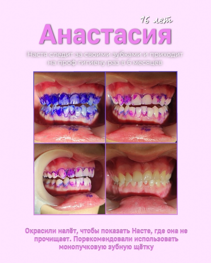 Клинический случай до и после