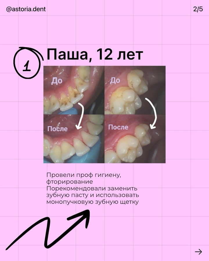 Клинический случай до и после