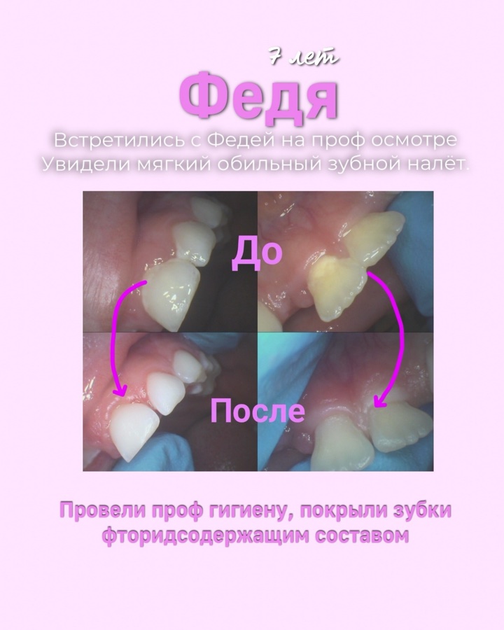 Клинический случай до и после